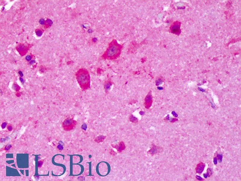 IHC-plus™ GRM8 / MGLUR8 Antibody (N-Terminus)