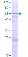 Human HIBCH Protein (Recombinant GST)