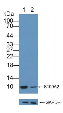 Polyclonal Rabbit anti-Human S100A2 Antibody (aa529-615, WB)