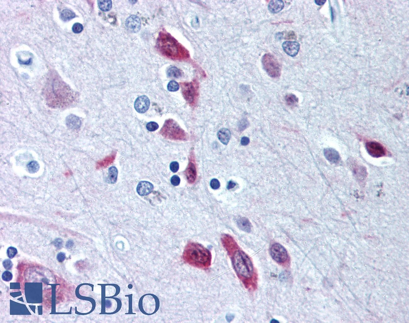 BIRC5 / Survivin Antibody (phospho-Thr34, Biotin)