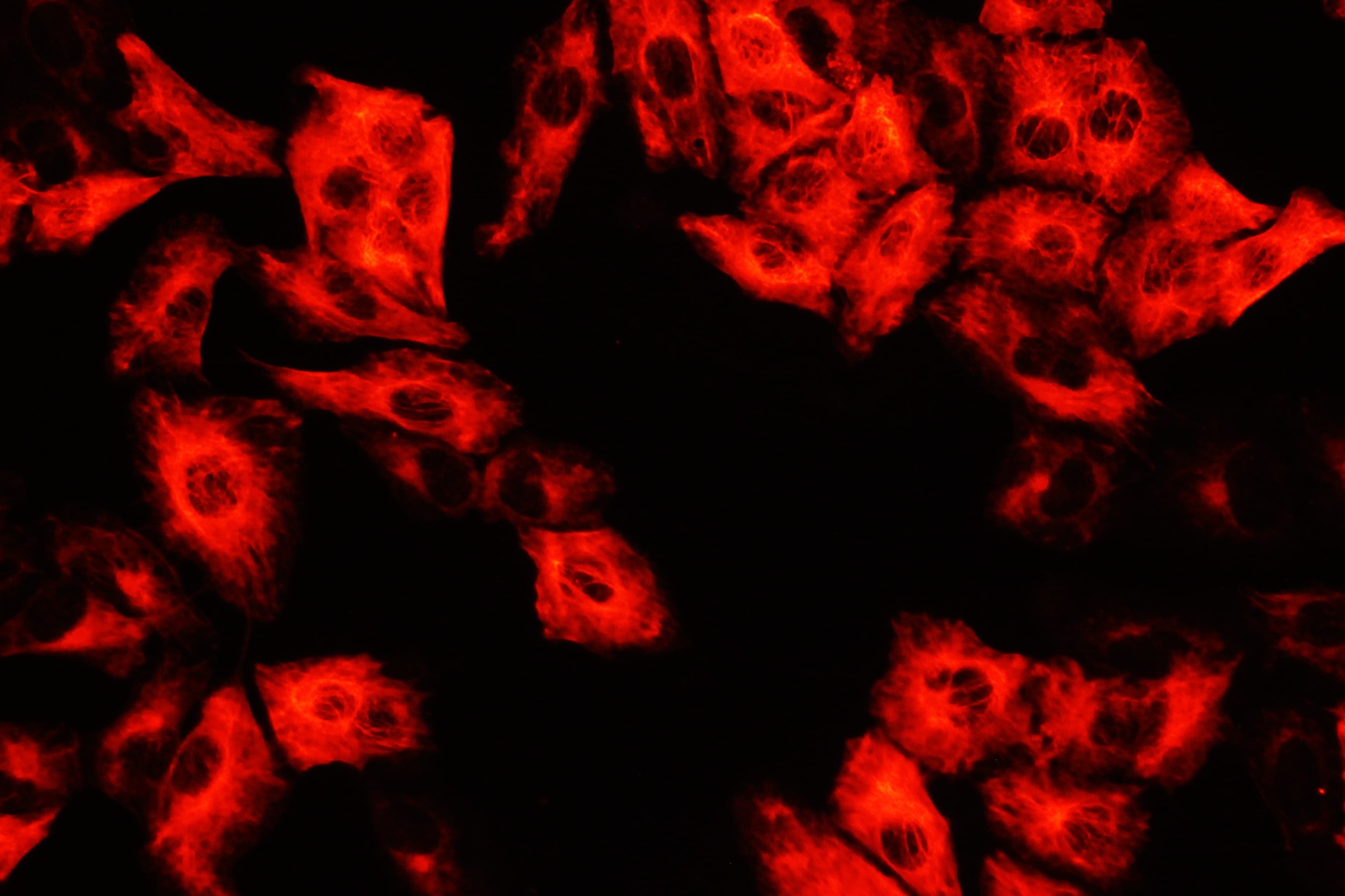 ECI1 / DCI Antibody (aa272-290)