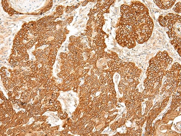 SLC6A9 / GLYT1 Antibody