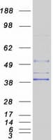 Human AGPAT5 Protein (Recombinant Myc-DDK (Flag))
