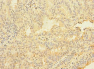 ASTL Antibody