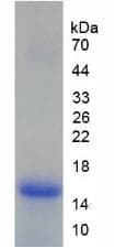 Human LY96 / MD2 / MD-2 Protein (Recombinant His)