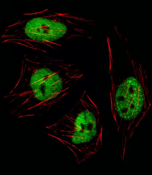 GTF2I / TFII I Antibody (aa281-310)