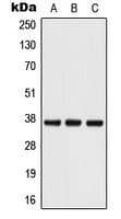 Polyclonal Rabbit anti-Human PDPN / Podoplanin Antibody (Internal, WB)