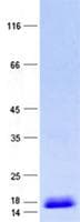 Human C22orf24 Protein (Recombinant His, N-Terminal)