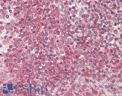 IHC-plus™ Heat Shock Protein 70 / HSPA1A Antibody (clone 5F3)