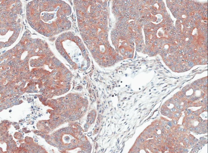 Polyclonal Rabbit anti-Human Mannose Phosphate Isomerase Antibody (aa150-423, IHC, WB)