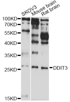 IHC-plus™ Polyclonal Rabbit anti-Human DDIT3 / CHOP Antibody (IHC, IF, WB)
