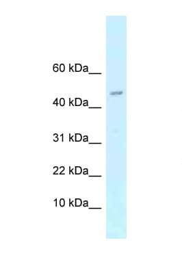 RCS / ARPP-21 Antibody (aa21-70)