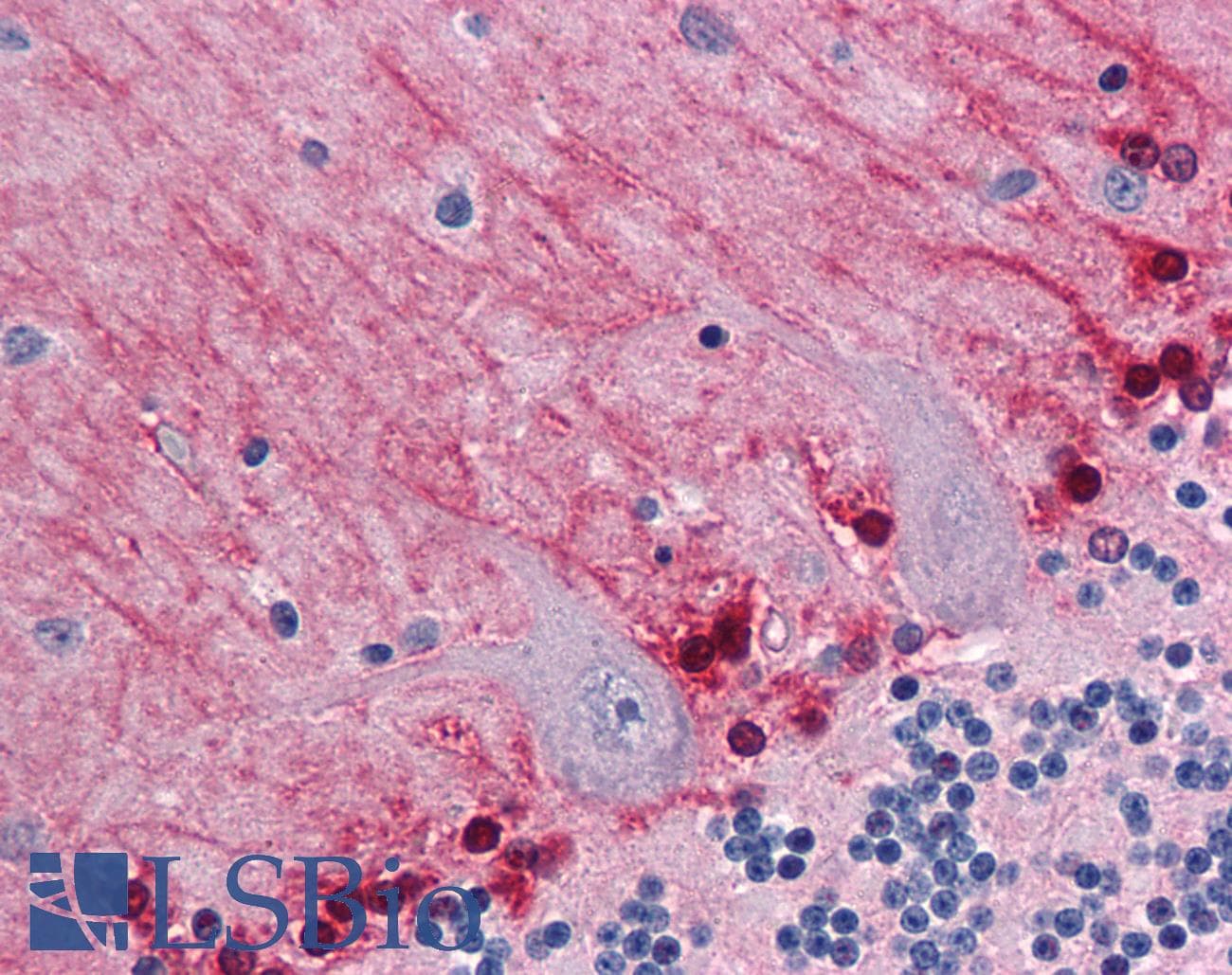 IHC-plus™ GYG1 / Glycogenin Antibody (clone 3B5)