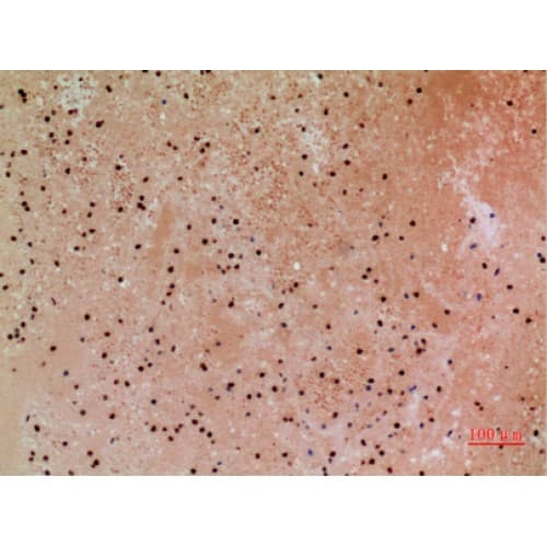 Polyclonal Rabbit anti-Human CACYBP Antibody (161-210 aa, C-terminal, IHC, WB)