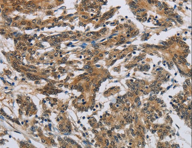 SYN1 / Synapsin 1 Antibody
