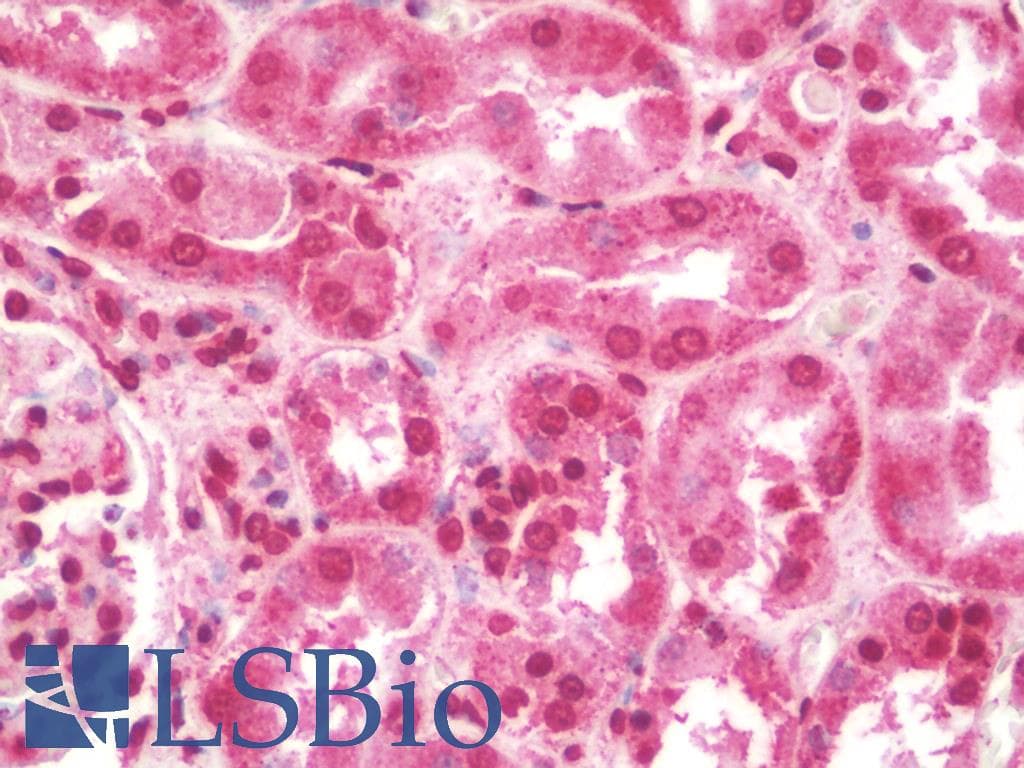 IHC-plus™ Polyclonal Rabbit anti-Human CNRIP1 Antibody (IHC, IF, WB)