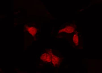AURKB / Aurora-B Antibody