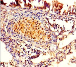 Polyclonal Rabbit anti-Human FAM161A Antibody
