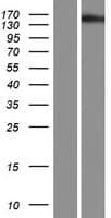 TBC1D32 / C6orf170 Protein (Over-Expression Lysate Myc-DDK (Flag))