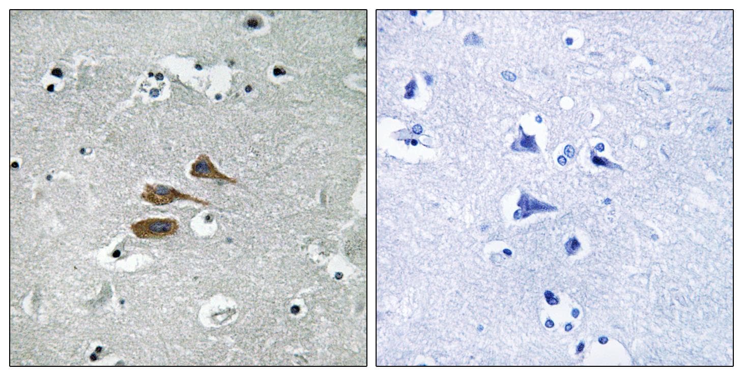 Polyclonal Rabbit anti-Human MARCH3 Antibody (IHC, WB)