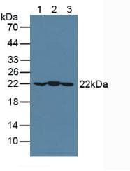 CRYAB / Alpha B Crystallin Antibody (aa1-175, Biotin)