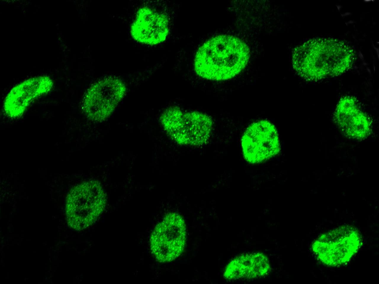 RARB / RAR Beta Antibody (Preservative Free)