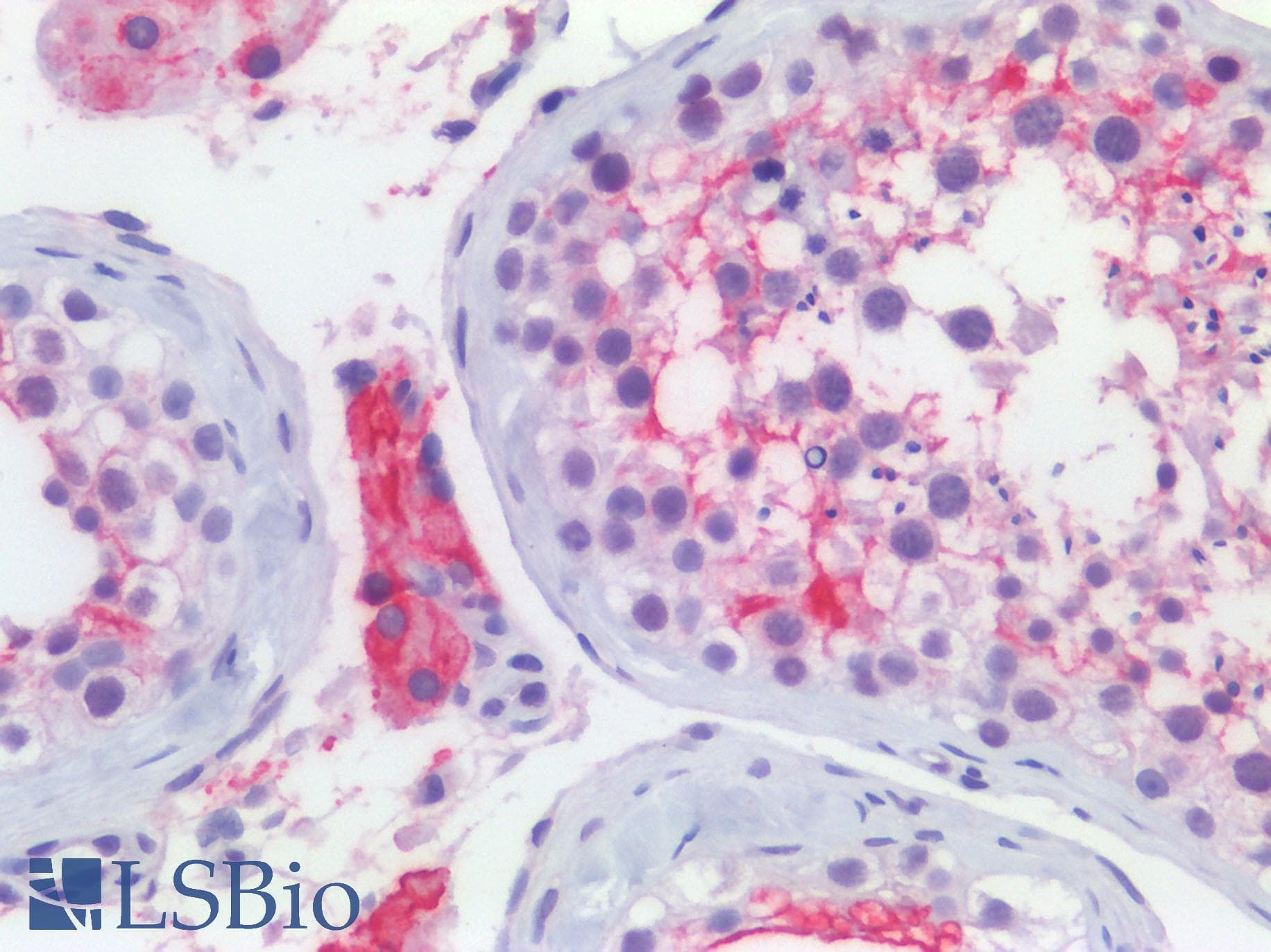 IHC-plus™ ACE2 / ACE-2 Antibody (aa140-172)