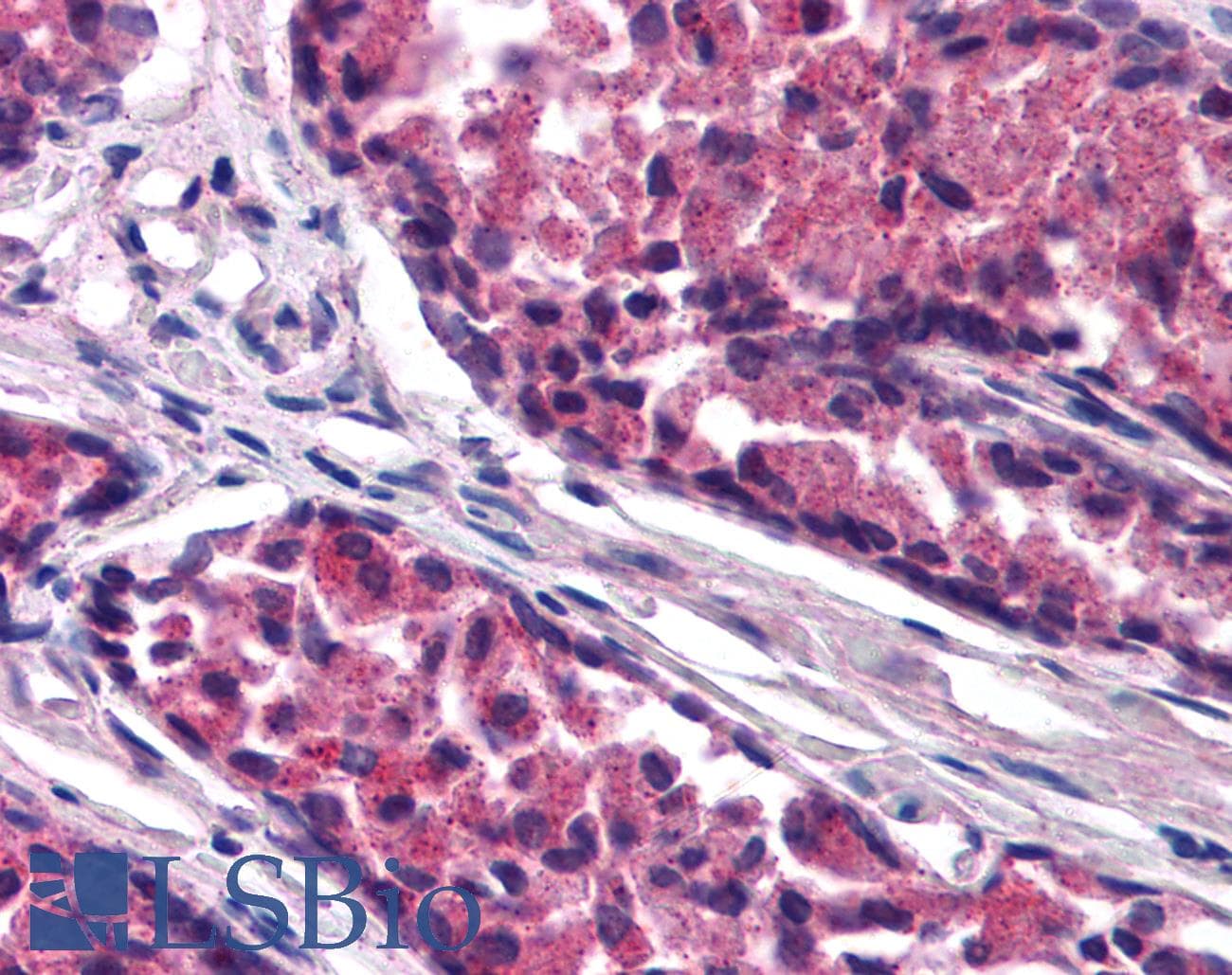 IHC-plus™ ARHGAP33 / SNX26 Antibody (aa3-14)