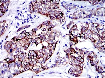 KRT19 / CK19 / Cytokeratin 19 Antibody (clone 400000000)