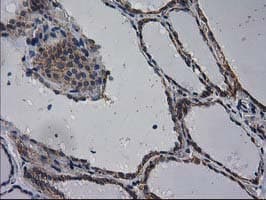 EIF4E2 / IF4e Antibody (clone OTI1F11)