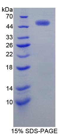 Human ERBB2 / HER2 Protein (Recombinant His-GST)