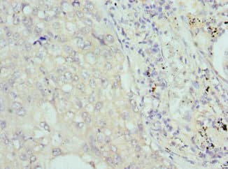 Polyclonal Rabbit anti-Human Cochlin / COCH Antibody (IHC)