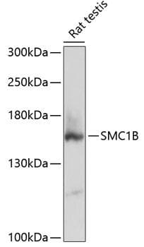 Polyclonal Rabbit anti-Human SMC1B Antibody (WB)