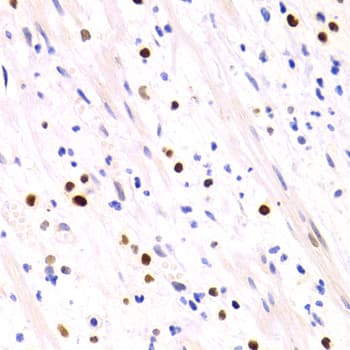 Polyclonal Rabbit anti-Human SIP1 Antibody (IHC, IF, WB)