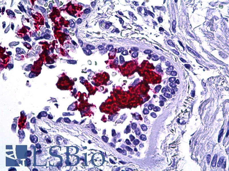 IHC-plus™ Monoclonal Mouse anti-Human MUC5AC Antibody (clone 1-13M1, Concentrated, IHC, WB)