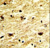 EXOSC8 Antibody (aa243-276)