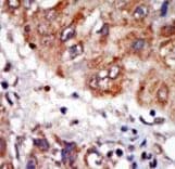 Polyclonal Rabbit anti-Human LIMK1 / LIMK Antibody (aa1-30, IHC, WB)