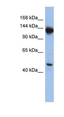 NRD1 / Nardilysin Antibody (aa1079-1128)