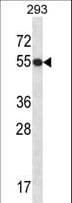 GTF2E1 Antibody (aa93-121)