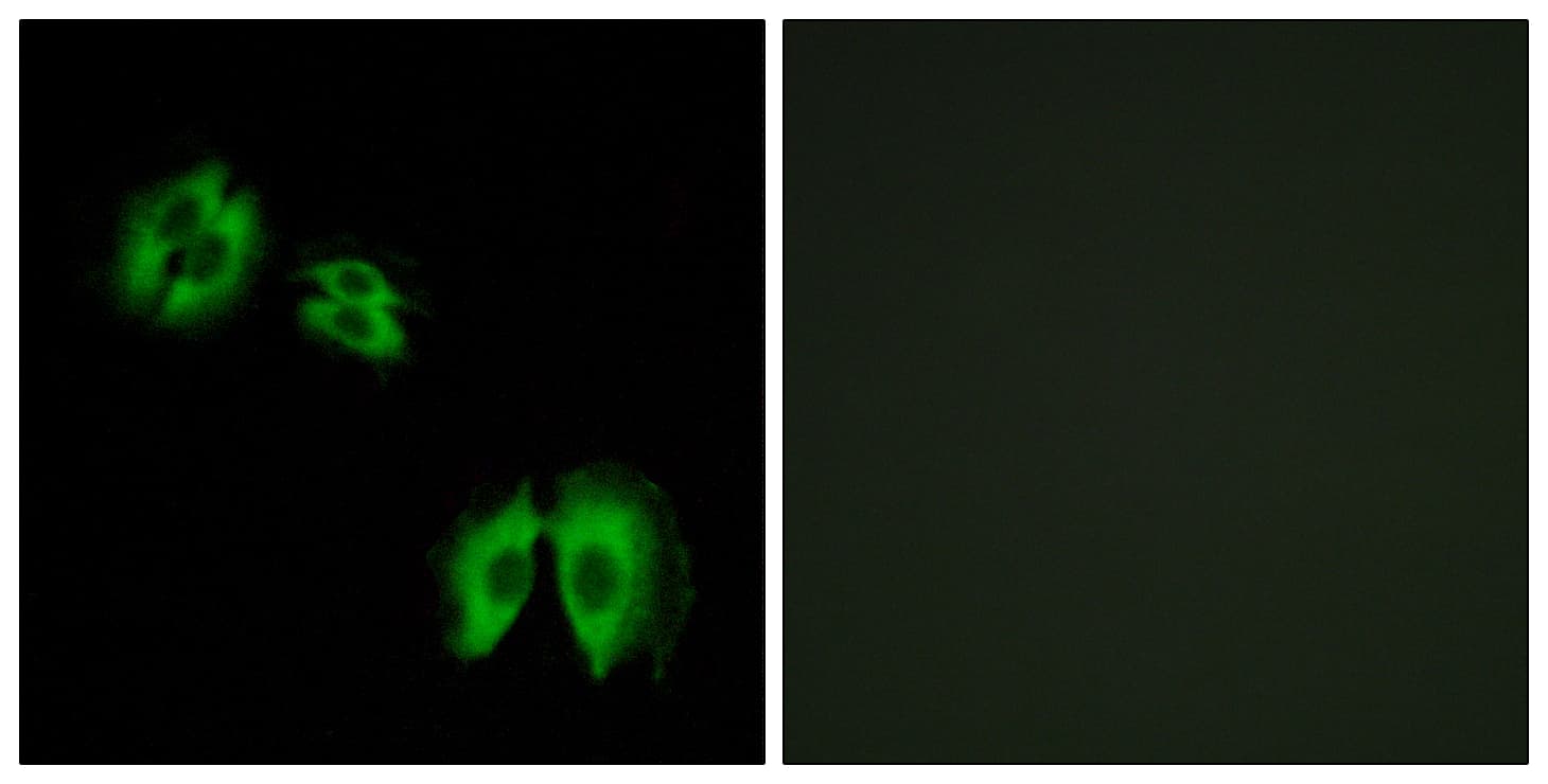 GLCT2 / B3GALT2 Antibody (aa373-422)