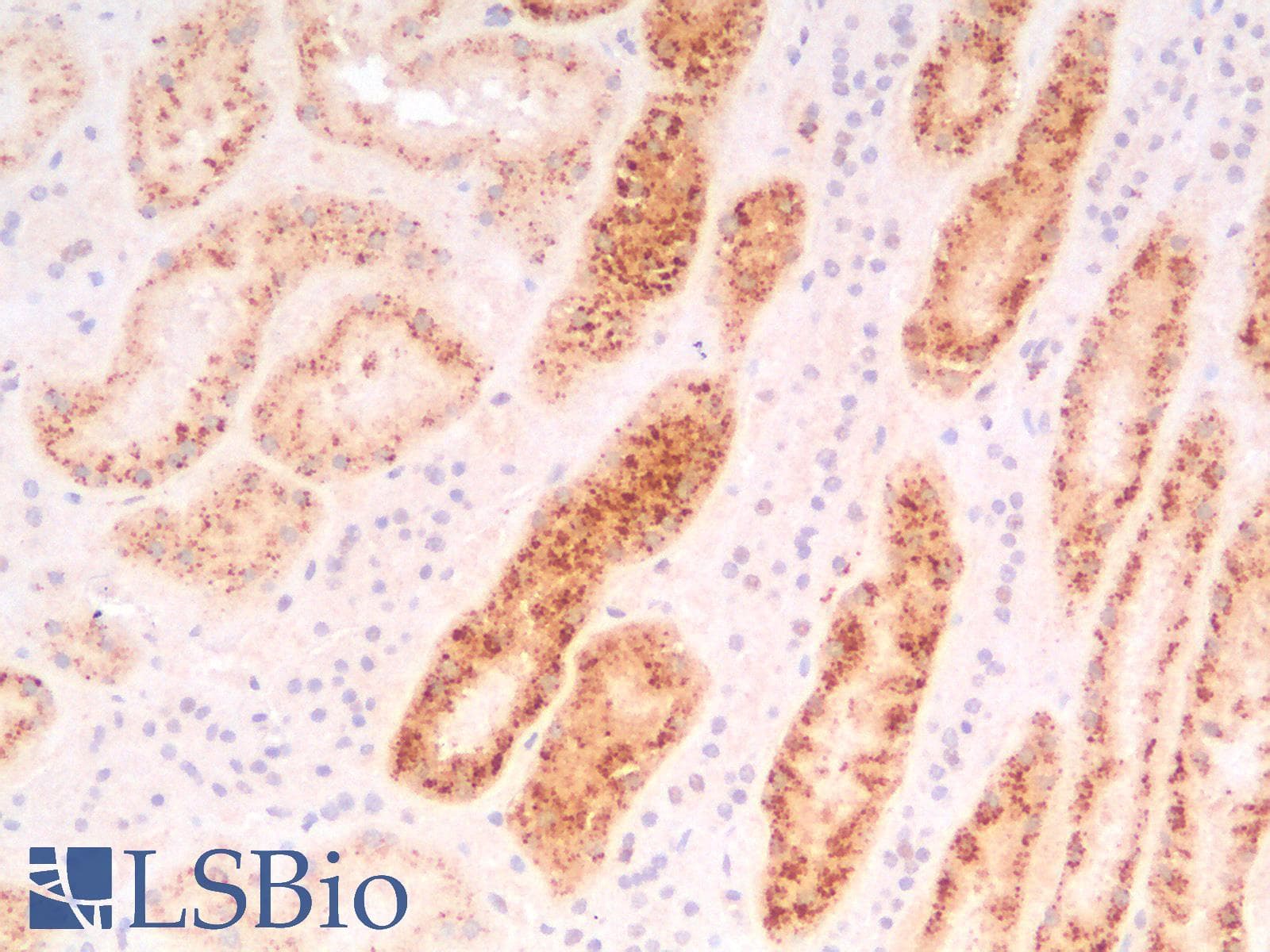 IHC-plus™ NAPSA / NAPA / Napsin A Antibody (aa189-299, clone rNAPSA/1239)