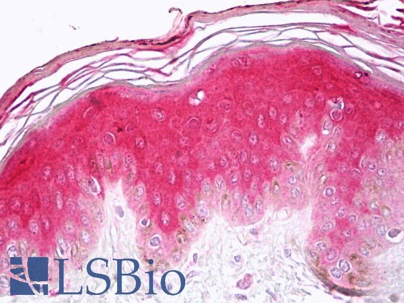 IHC-plus™ CASP14 / Caspase 14 Antibody (N-Terminus)