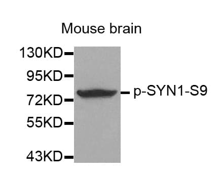 SYN1 / Synapsin 1 Antibody (phospho-Ser9)