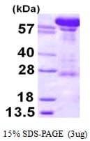 Human KPNB1 / Importin Beta Protein (Recombinant His)