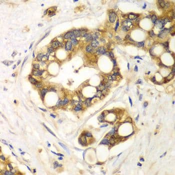 Polyclonal Rabbit anti-Human RPH3A / Rabphilin 3A Antibody (IHC, WB)
