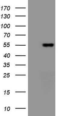 VEGFD Antibody (aa89-205, clone OTI2A1, Carrier-free)