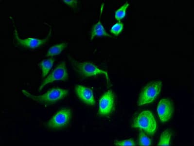 Polyclonal Rabbit anti-Human FATE1 Antibody (WB)