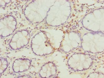 Polyclonal Rabbit anti-Human FAM82B Antibody (IHC, WB)