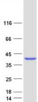 Human RBKS / Ribokinase Protein (Recombinant Myc-DDK (Flag))