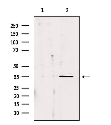 CA13 / Carbonic Anhydrase XIII Antibody